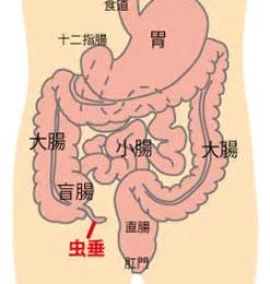 盲腸是這樣切除的